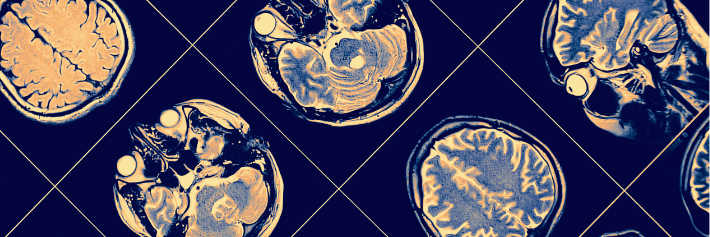 visita neurochirurgica rieti