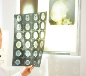 visita neurologica rieti