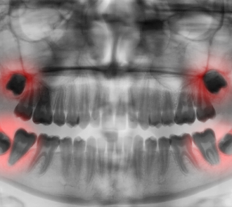 DENTALSCAN RIETI (3)