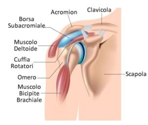 tendinite della spalla